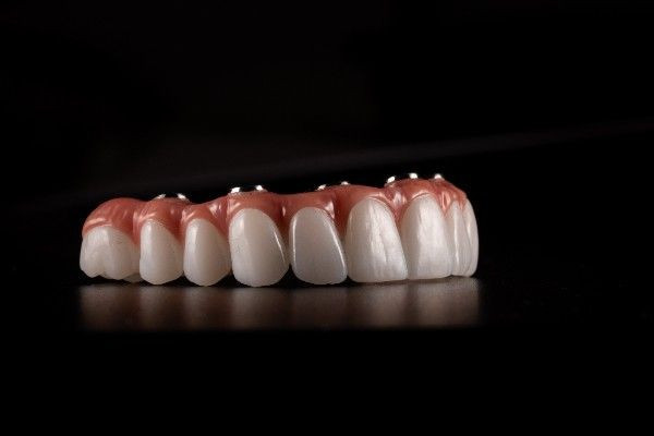 Dental implants in Watford