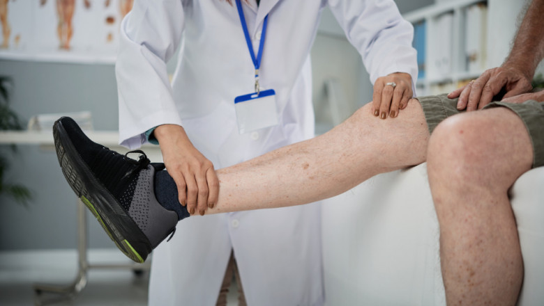 How Lifeline Turkey Became a Trusted Varicose Veins Surgery Centre in Turkey?