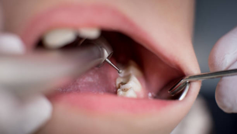 The Difference Between Emergency Dental Care and Urgent Care
