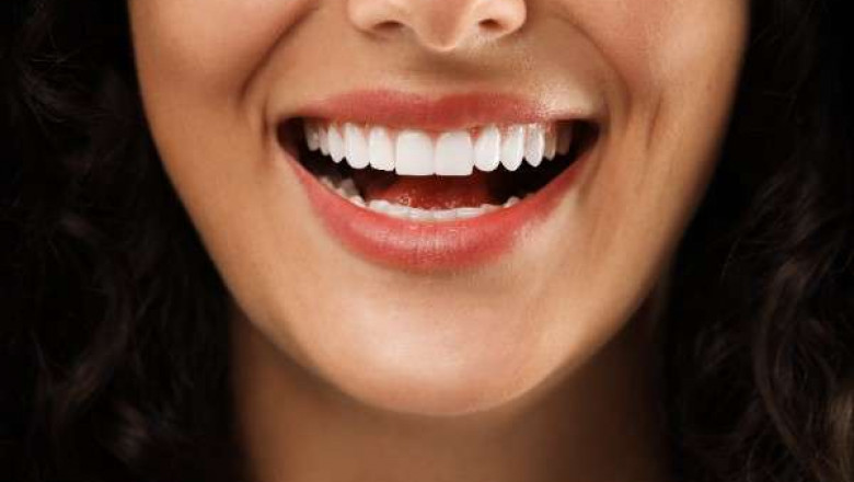 Watford’s Best Solutions for Smile Repair