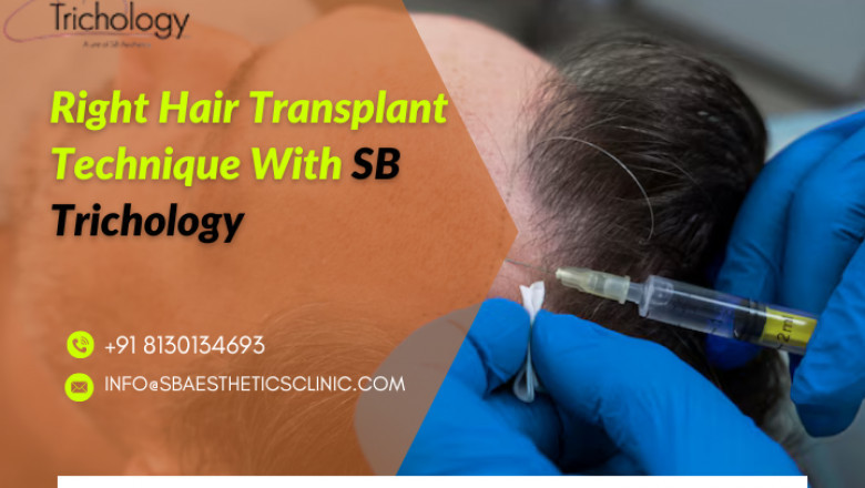 Choosing the right hair transplant technique: Which one is right for you?